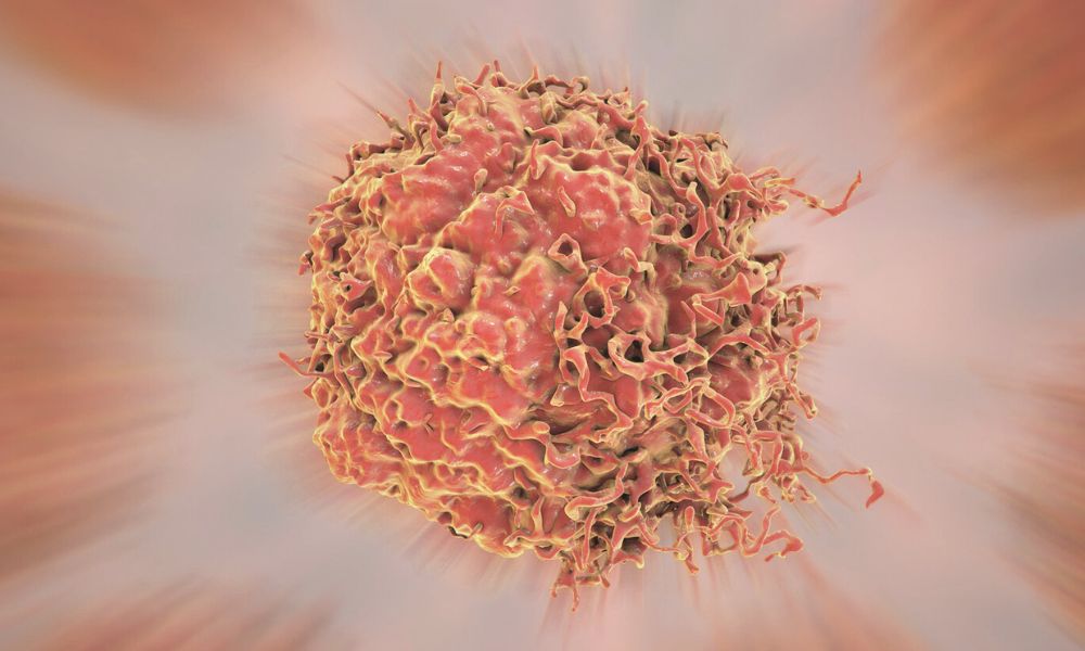 Condiloma Anal e HPV: entenda a importância do acompanhamento médico