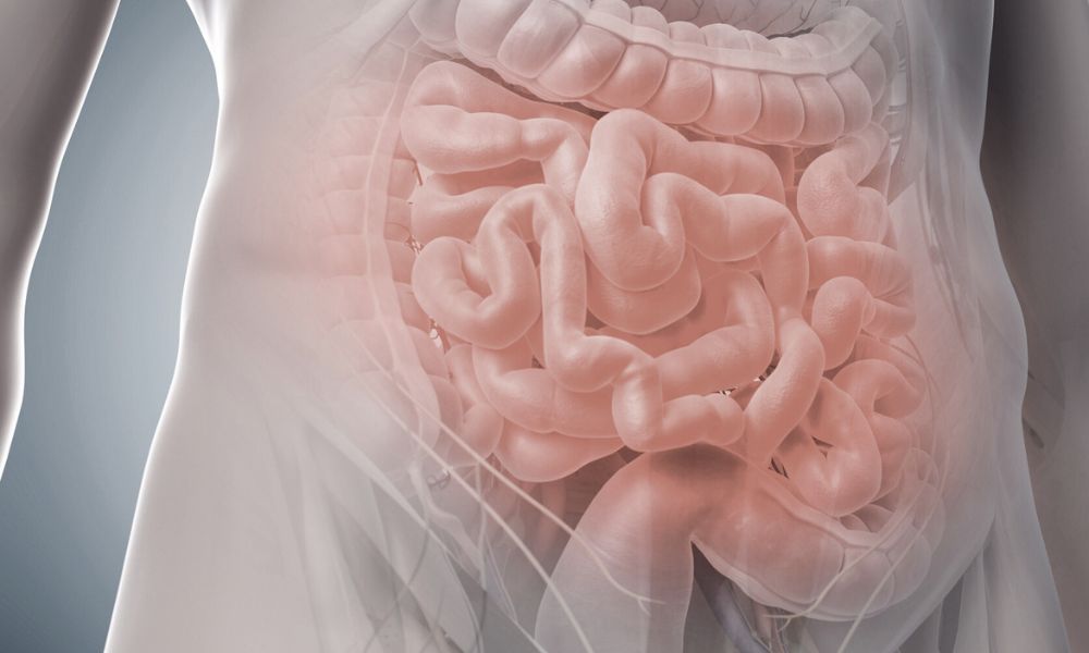 Diverticulose: O que é, sintomas, prevenção e quando procurar ajuda médica